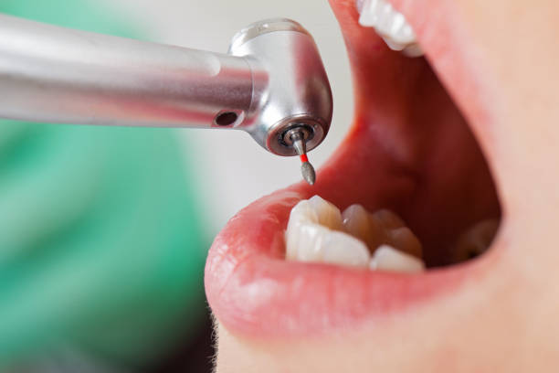 Best Pediatric Emergency Dentist in Avilla, IN